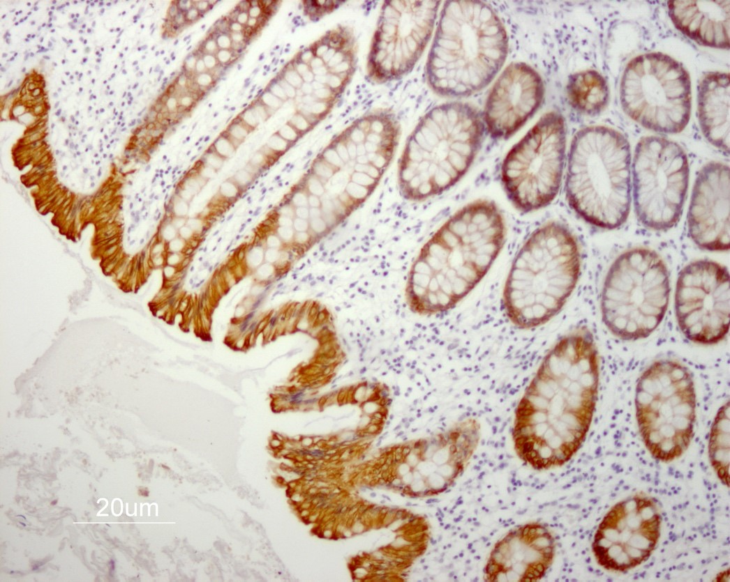 Figure 5. Indirect immunoperoxidase staining of human small intestine paraffin tissue section with MUB0329P (RCK108; Mouse anti keratin 19). Dilution 1:50 and microwave pretreatment. Specific staining of the epithelial cells. No reactivity in the connective tissues.
